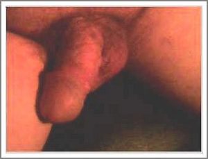 Compulsion2