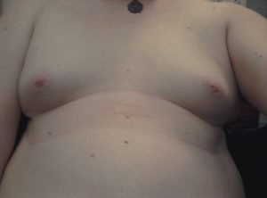Ravyn’s Breasts