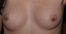 breasts
