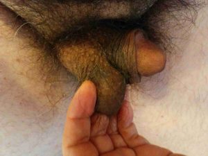 flaccid small