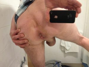 my-ass-_376_