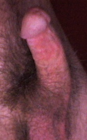 mycockagain
