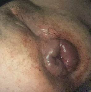 puffy_boicunt