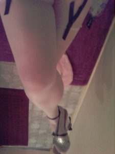 white legs